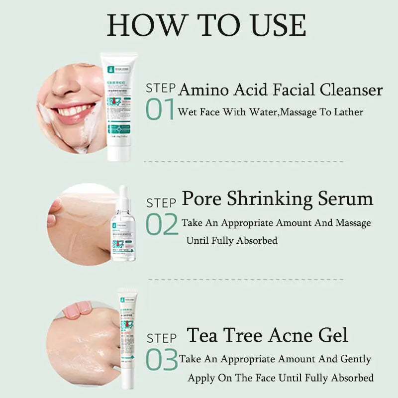 Herbal Acne Removal Face Cream